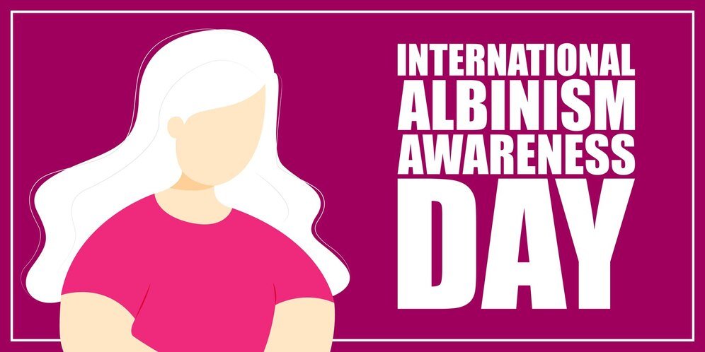 International Albinism Awareness Day